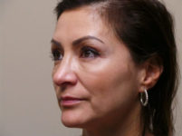 After Image