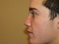 After Image